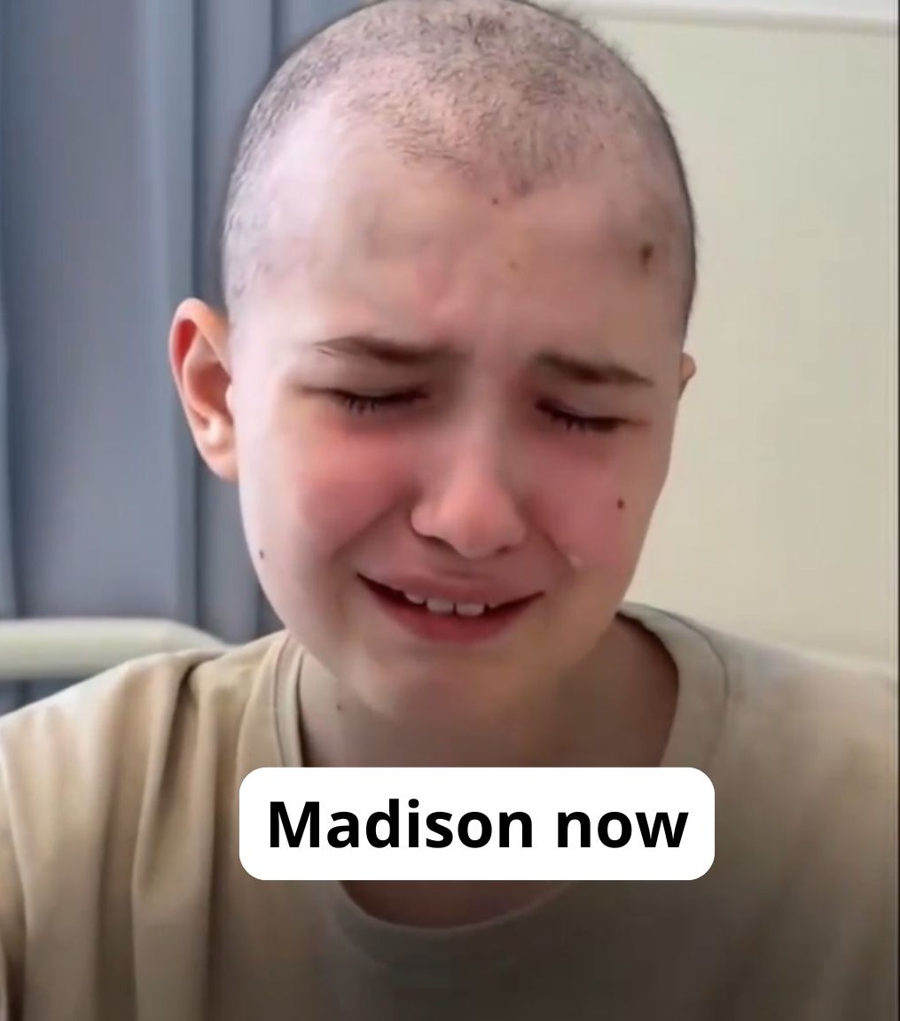 Madison tratamento